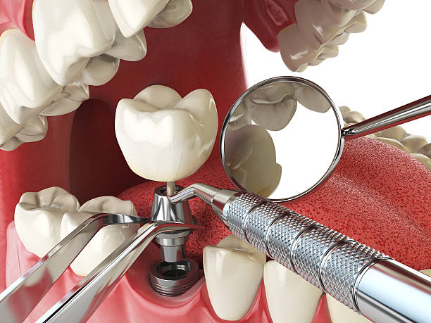 Best Emergency Dentist for Knocked-Out Tooth in Houston, AK
